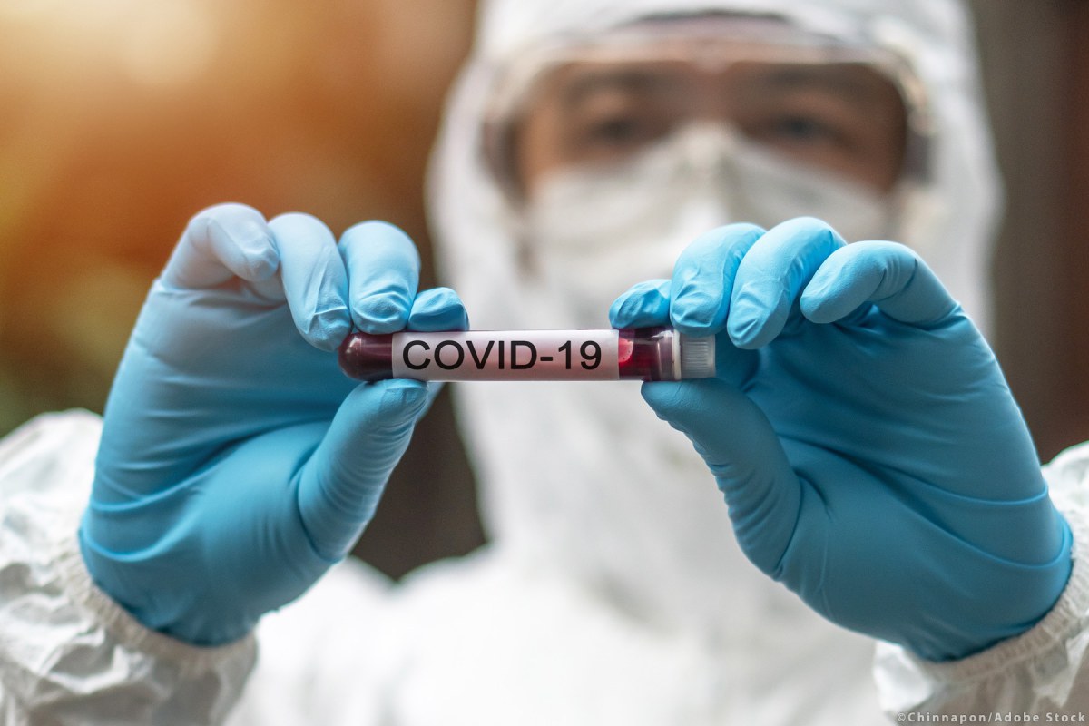 Vial of blood for coronavirus testing ©Chinnapong/AdobeStock 