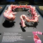 Impressions of BODY WORLDS RX